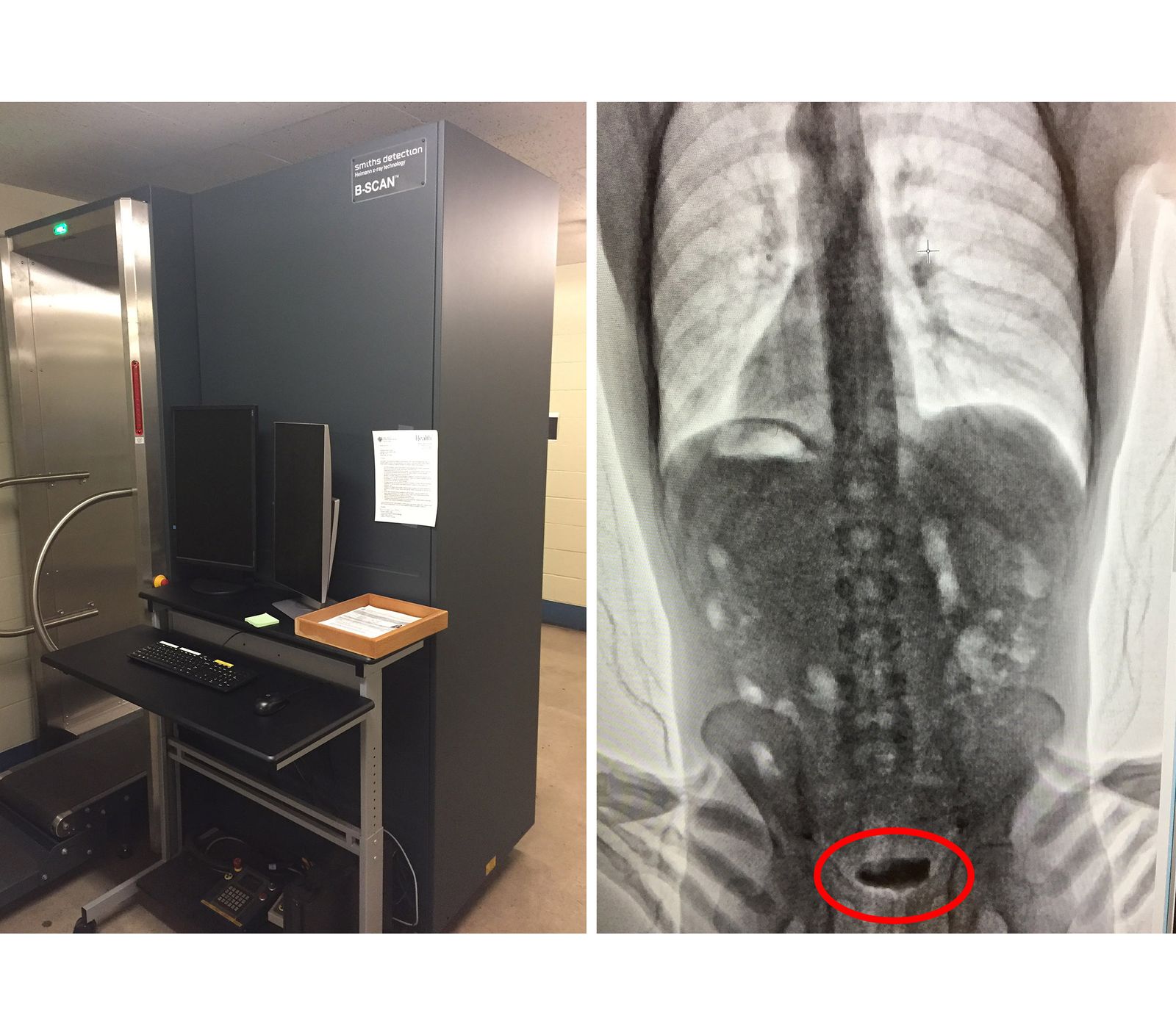 How One Oregon Jail Uses X Ray Screening To Keep Out Contraband Drugs